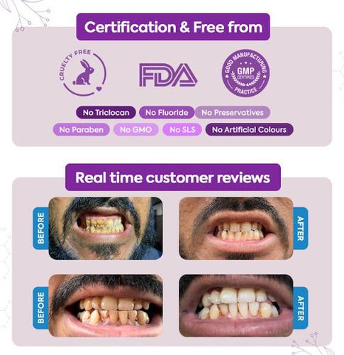 Bioveda White 365 -Teeth Whitening Powder	
