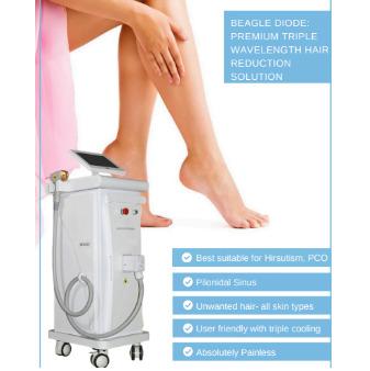 BEAGLE DIODE: PREMIUM TRIPLE WAVELENGTH HAIR REDUCTION SOLUTION	
