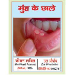 Mouth Ulcers