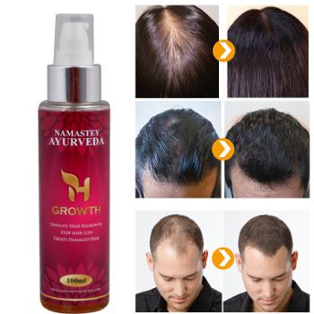 Hair Regrowth Oil