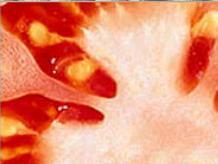 Tomato seed