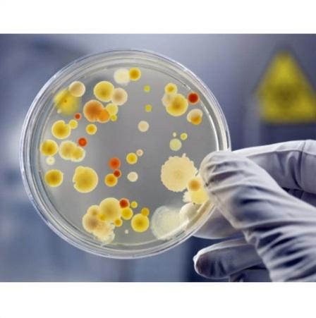 Bacteria Culture