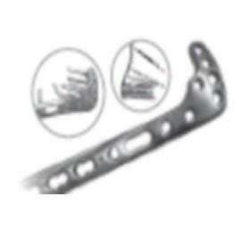 AS. Proximal Lateral Tibial Plate