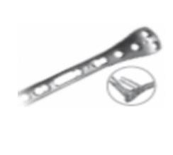 AS. Postero-Medial Proximal Tibial Plate