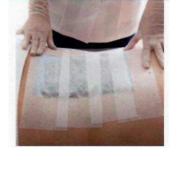 Artcure Diffusional Patch