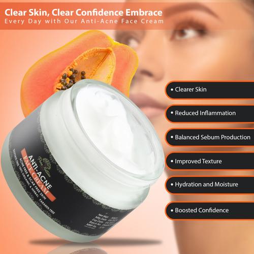 Anti Acne Face Cream