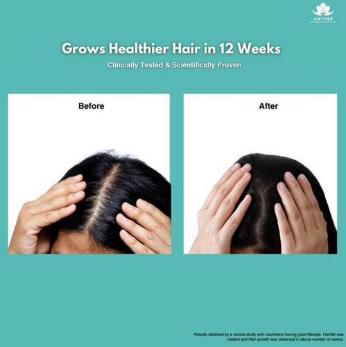Anther Hair Growth Oil
