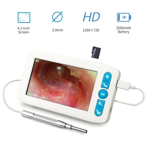 Video Otoscope