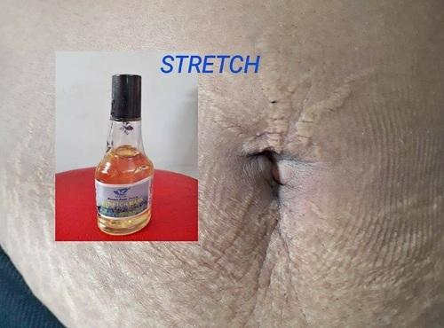 Anti Strecth Marks Oil
